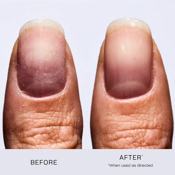 Nagellack Opi Nail Envy Original Nail Envy - Original 15 ml Nagelhärter